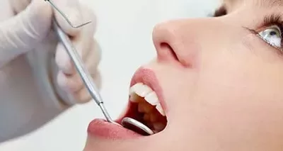 Your Smile Makeover