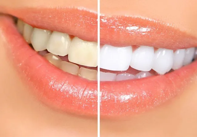 All Natural Teeth Whitening Tips!