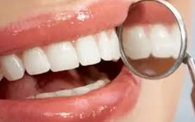 Bad Genes lead to Bad Teeth?