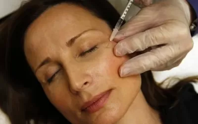 Questions About Botox Answered